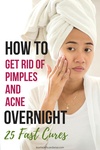 how to get rid of acne pimples overnight