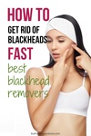 get rid of blackheads best blackhead removers