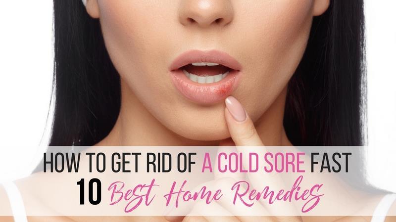 how to get rid of cold sores